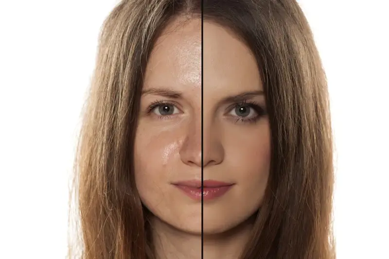 Viso diviso: a sinistra pelle con sebo e imperfezioni, a destra pelle uniformata dal trucco.